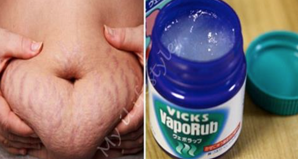 vicks vaporub for flat stomach